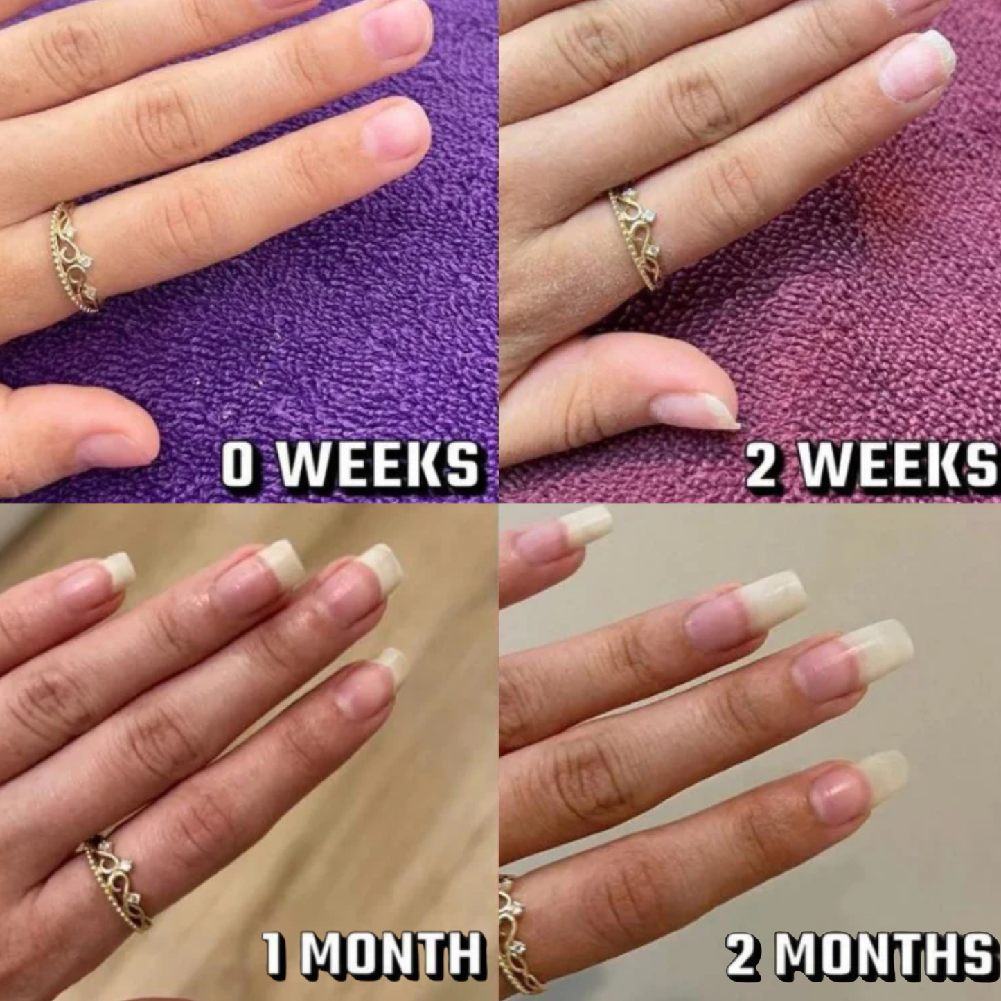 The Nail Fix™ Pen
