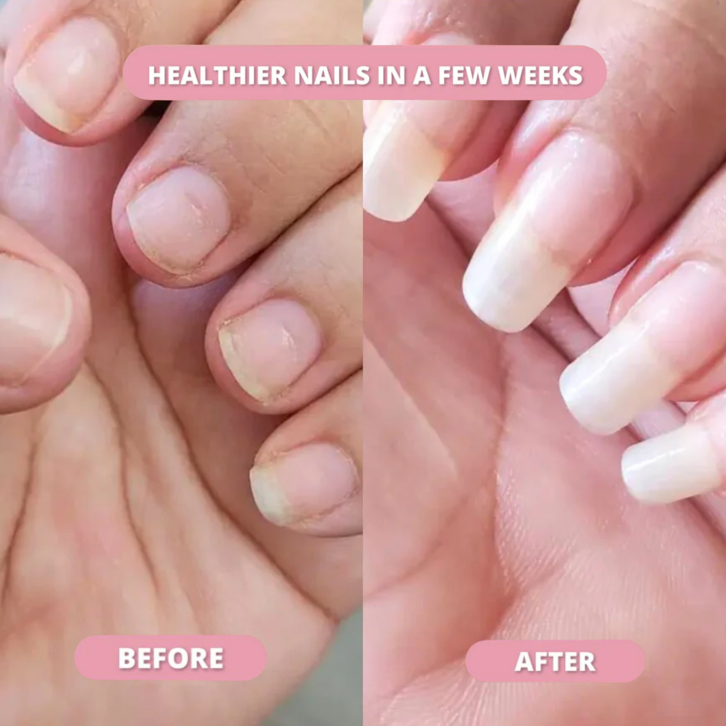The Nail Fix™ Pen