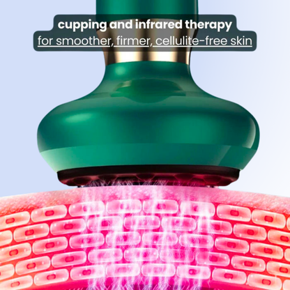 CelluCup™ Infrared Cupping Massager