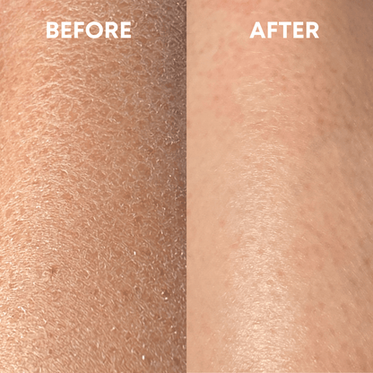 SmoothBuff™ Body Exfoliating Glove