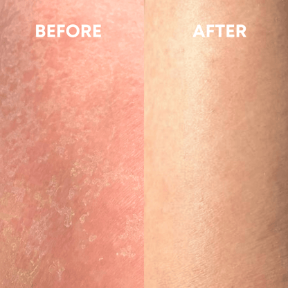 SmoothBuff™ Body Exfoliating Glove